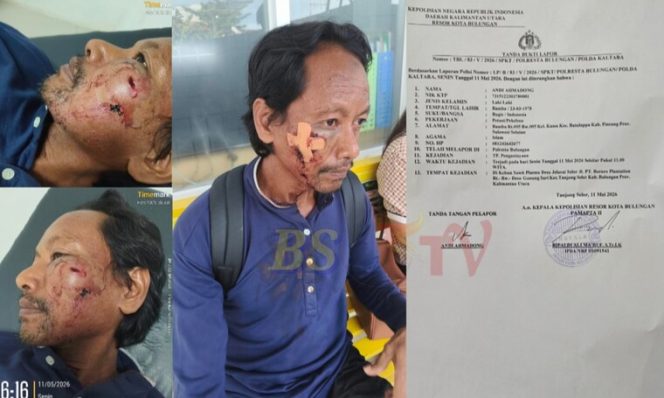 
 Biadab! Petani di Bulungan Dikeroyok Oknum Pengurus Koperasi, Wajah Korban Luka Berlubang