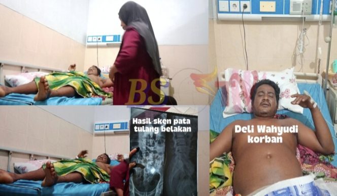 
 Diduga Melanggar Aturan BPJS, RSUD dr. Abdul Rivai Bebankan Biaya Rujukan Rp5 Juta pada Pasien Patah Tulang Belakang